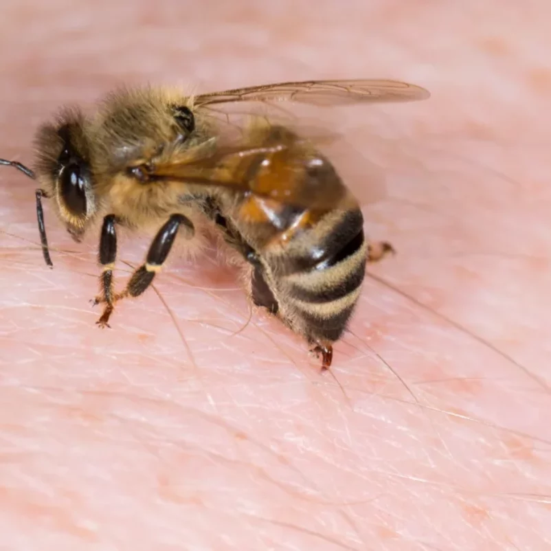 does tobacco draw out bee sting List of products What To Do For A